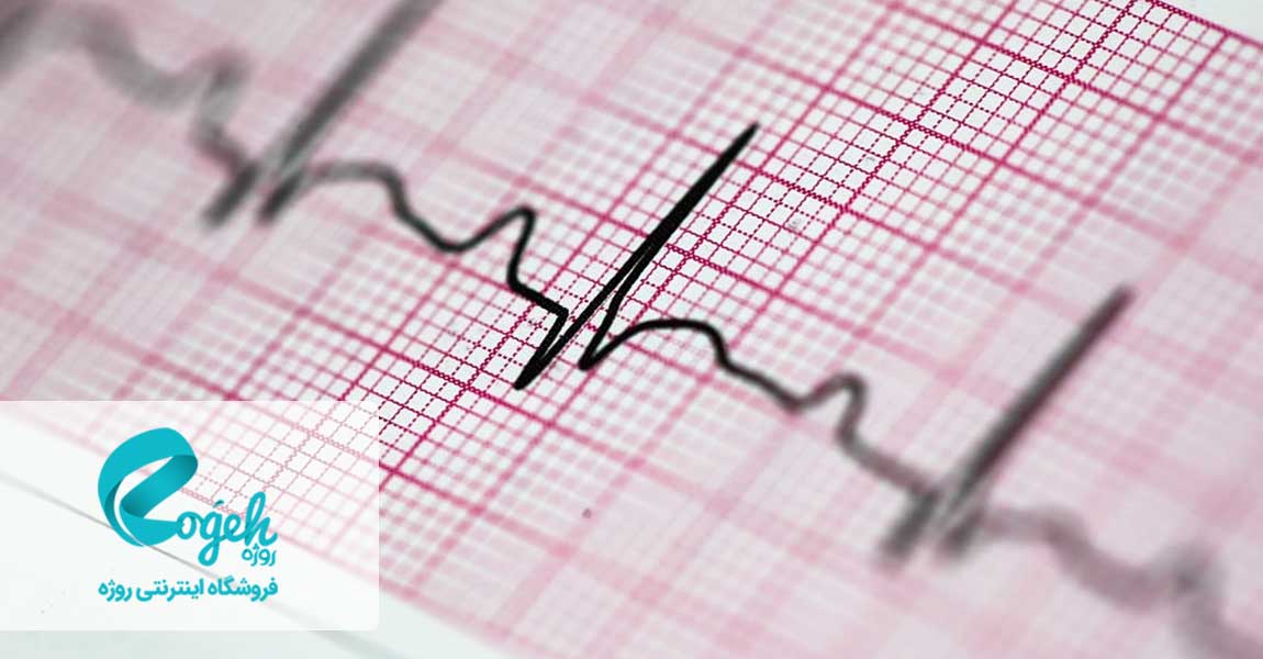 نوار قلب (ECG)