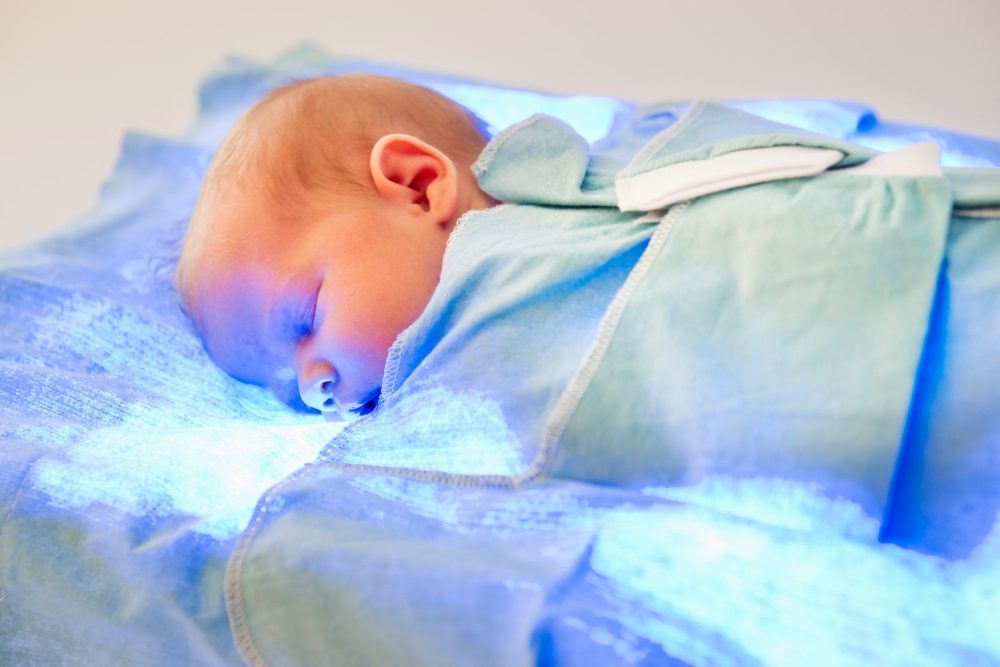 زردی نوزاد چقدر طول می‌کشد و چگونه می‌توان آن را درمان کرد؟ - روژه