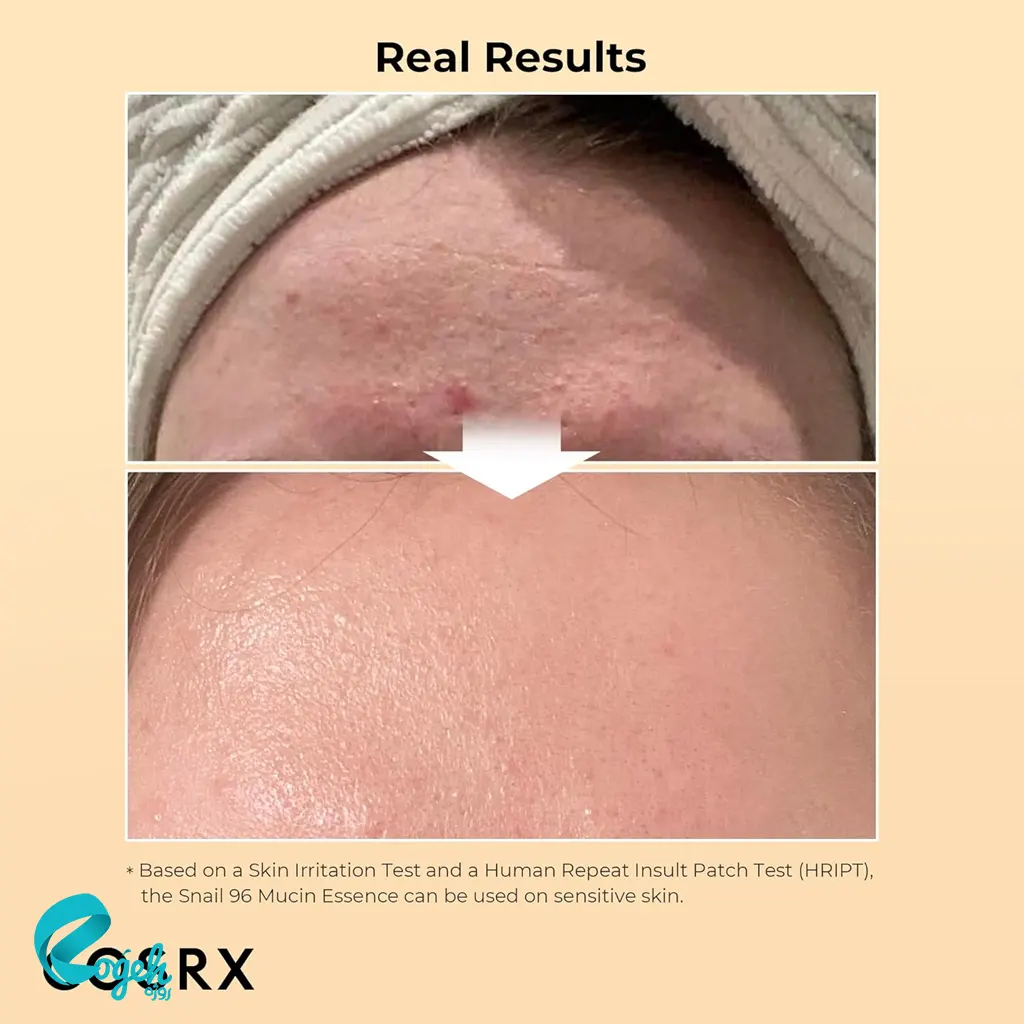 اسنس حلزون کوزارکس COSRX Advanced Snail 96 Mucin Power Essence – آبرسانی و ترمیم پوست با ۹۶٪ موسین حلزون​